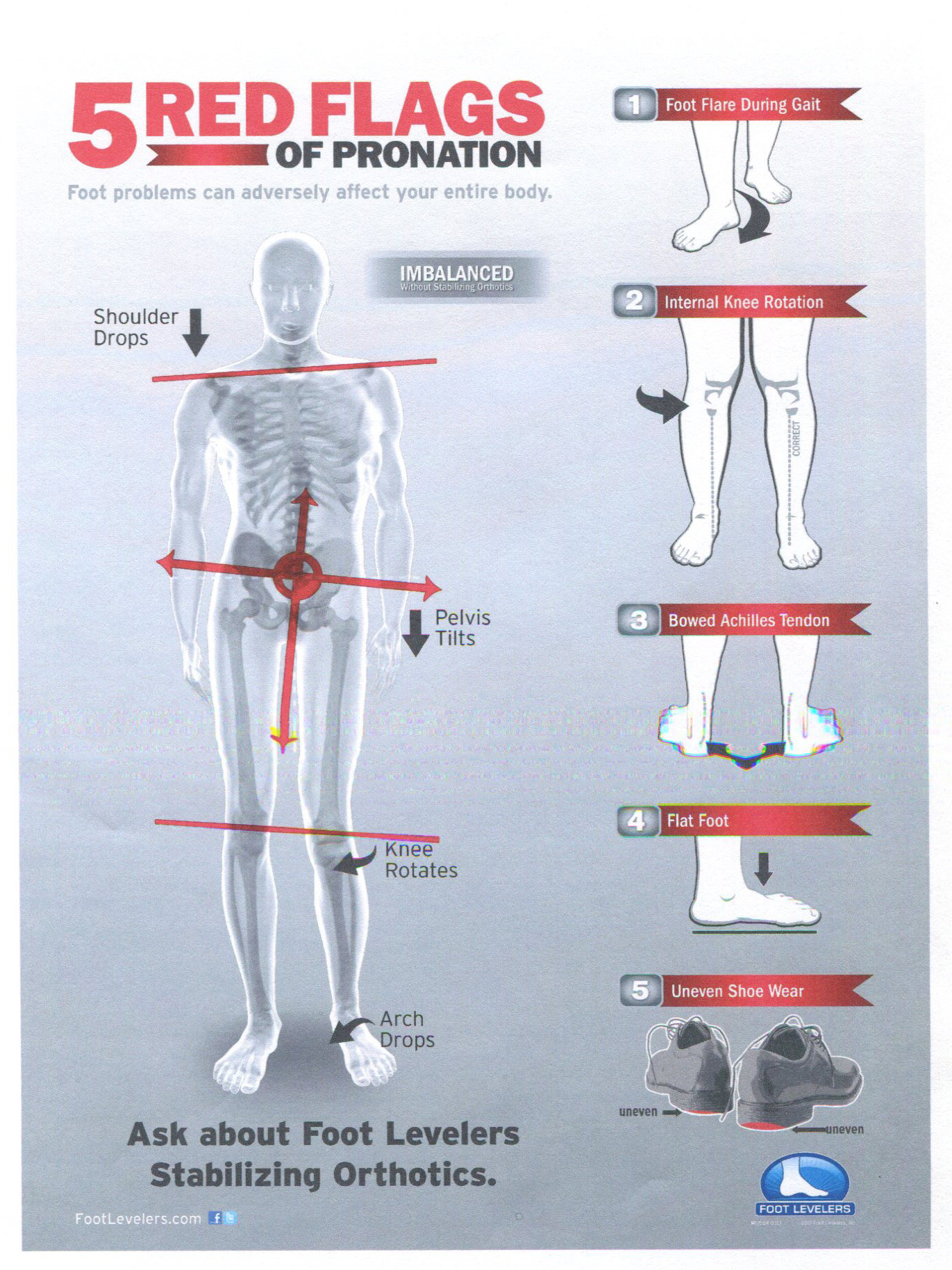 Chiropractor in Merrillville | Custom Made Foot Orthotics in ...